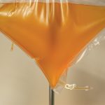 Die Durchführung der INUSpherese®